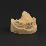 مدل جا نمایی ایمپلنت Hoss