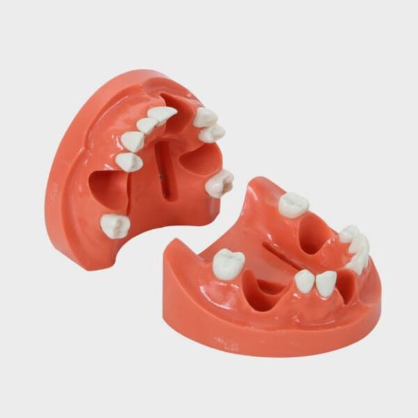 مدل فک جهت عکس برداری از دندان(سنسور) حاس