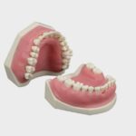 مدل تمرینی پریودنتال با لثه مات برای آموزش جراحی لثه