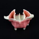 تصویر فک بالا بی دندانی Hoss