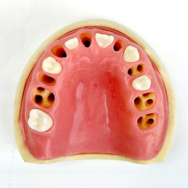 ST120 فک بالا ساکت دندانی ایمپلنت برند Hoss