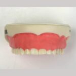 مدل تمرینی افزایش طول تاج با بافت نرم