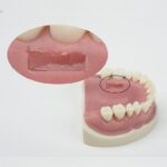 مدل تمرینی تحلیل لثه فک بالا با پریوست