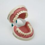 مدل تمرینی تحلیل لثه فک پایین با پریوست - مدل تمرینی تحلیل لثه دو فک با آرتیکولاتور و پریوست