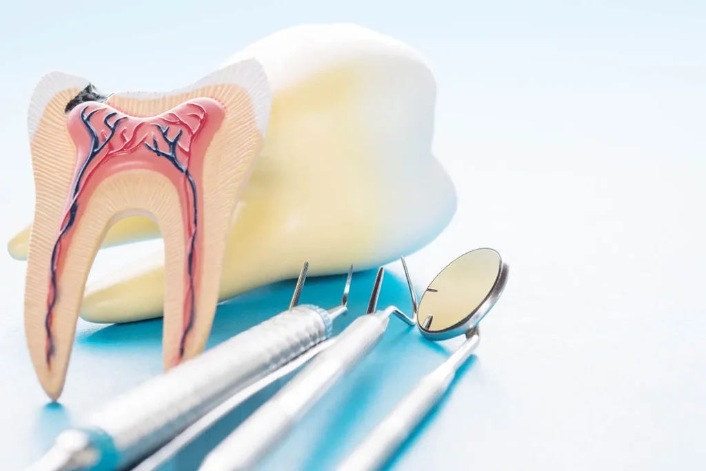 اندودانتیکس - Endodontics